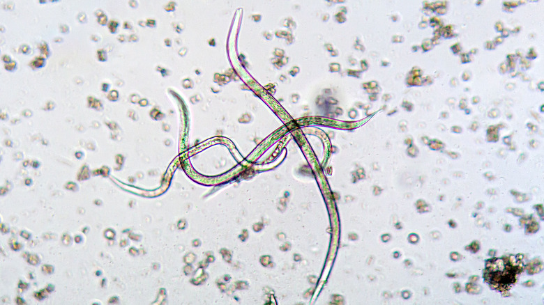 An image of nematode worms under a microscope