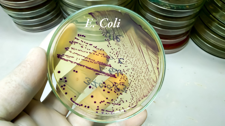 An E. coli bacteria in petri dish