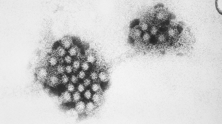 An electron micrograph of Norovirus